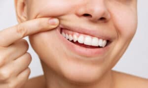 Non - Surgical Gum Treatments